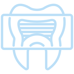 Light blue outline of a tooth with a rectangular dental X-ray image overlaying the upper half, showing internal tooth structures and lines, on a light gray background—ideal for vet or veterinarian dental care visuals.